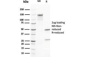 SDS-PAGE (SDS) image for anti-Calbindin 2 (CALB2) (AA 23-242) antibody (ABIN6940931)