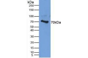 Detection of AGC in Human Cartilage Tissue using Polyclonal Antibody to Aggrecan (AGC) (Aggrecan 抗体  (AA 34-147))