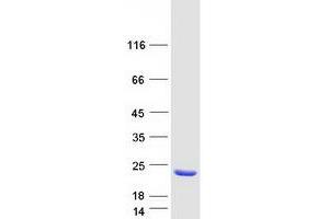 Western Blotting (WB) image for AHNAK Nucleoprotein (AHNAK) (Transcript Variant 2) protein (Myc-DYKDDDDK Tag) (ABIN2714476)