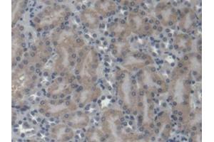 DAB staining on IHC-P; Samples: Mouse Kidney Tissue (EPRS 抗体  (AA 1007-1512))