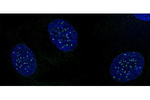 CENP-A phospho Ser18 antibody (pAb) tested by immunofluorescence. (CENPA 抗体  (pSer16, pSer18))
