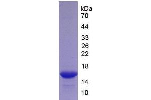 Image no. 1 for Tumor Necrosis Factor Receptor Superfamily, Member 9 (TNFRSF9) (AA 40-153) (Active) protein (His tag) (ABIN6239777)