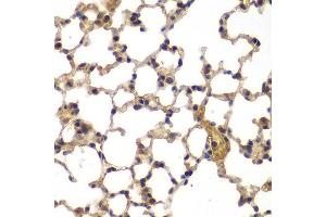 Immunohistochemistry of paraffin-embedded mouse lung using ASPSCR1 antibody at dilution of 1:100 (x400 lens). (ASPSCR1 抗体)