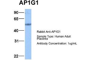 Host: Rabbit Target Name: AP1G1 Sample Type: Human Adult Placenta Antibody Dilution: 1. (gamma 1 Adaptin 抗体  (C-Term))