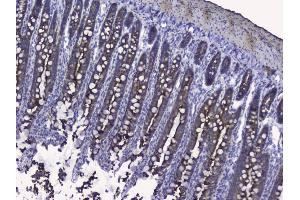 IHC analysis of Cytokeratin 19 using anti-Cytokeratin 19 antibody (ABIN3043288). (Cytokeratin 19 抗体  (C-Term))