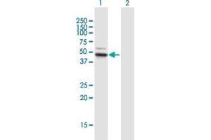 Western Blot analysis of ALDH3B1 expression in transfected 293T cell line by ALDH3B1 MaxPab polyclonal antibody. (ALDH3B1 抗体  (AA 1-431))