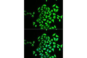 Immunofluorescence analysis of U2OS cells using NAPG antibody (ABIN5973832). (NAPG 抗体)