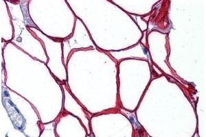 Human Adipocytes: Formalin-Fixed, Paraffin-Embedded (FFPE) (RNF25 抗体  (AA 377-439))