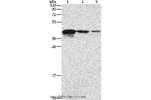Western blot analysis of Human endometrial carcinoma tissue, A172 and U937 cell, using TWF2 Polyclonal Antibody at dilution of 1:800 (TWF2 抗体)
