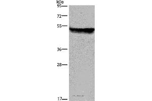 Western blot analysis of Mouse liver tissue, using CYP2E1 Polyclonal Antibody at dilution of 1:250 (CYP2E1 抗体)