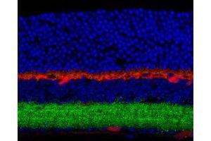 Immunostaining (ISt) image for anti-gamma-aminobutyric Acid (GABA) A Receptor, beta 3 (GABRB3) (Cytoplasmic Loop) antibody (ABIN6254100)