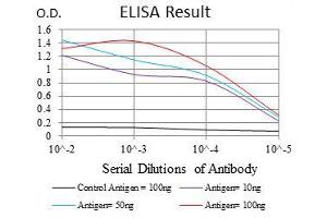 Black line: Control Antigen (100 ng), Purple line: Antigen(10 ng), Blue line: Antigen (50 ng), Red line: Antigen (100 ng), (Glucose-6-Phosphate Dehydrogenase 抗体)