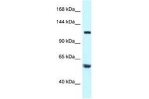 Image no. 1 for anti-Tubulin Folding Cofactor D (TBCD) (AA 299-348) antibody (ABIN6747499)