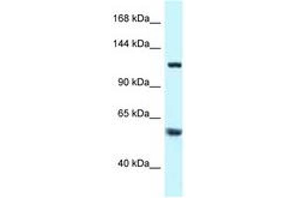TBCD antibody  (AA 299-348)