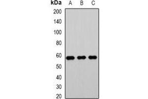 Western blot analysis of PHACS expression in Jurkat (A), mouse testis (B), rat kidney (C) whole cell lysates.