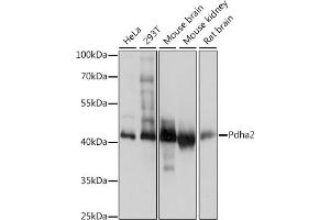 Western blot analysis of extracts of various cell lines, using Pdha2 antibody (ABIN7269770) at 1:1000 dilution.
