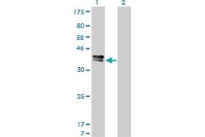 Western Blot analysis of ISL1 expression in transfected 293T cell line by ISL1 monoclonal antibody (M01), clone 1A3. (ISL1 抗体  (AA 63-159))