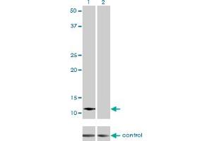Western blot analysis of ACYP2 over-expressed 293 cell line, cotransfected with ACYP2 Validated Chimera RNAi (Lane 2) or non-transfected control (Lane 1). (Acyp2 抗体  (AA 1-98))