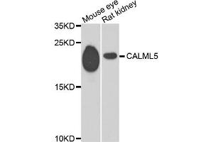 Western blot analysis of extracts of mouse eye and rat kidney, using CALML5 antibody. (CALML5 抗体)