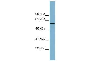 PGM3 antibody used at 1 ug/ml to detect target protein. (Phosphoglucomutase 3 抗体  (Middle Region))