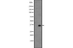 Western blot analysis of KLF14 expression in A431 whole cell lysate ,The lane on the left is treated with the antigen-specific peptide. (KLF14 抗体  (C-Term))