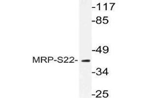 Western blot (WB) analysis of MRP-S22 antibody in extracts from COS cells. (MRPS22 抗体)