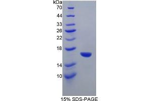 SDS-PAGE of Protein Standard from the Kit (Highly purified E. (GAD ELISA 试剂盒)