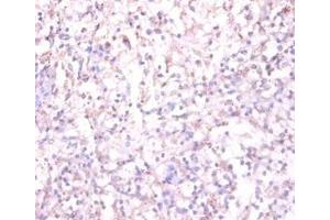 Immunohistochemistry of paraffin-embedded human spleen tissue using ABIN7170878 at dilution of 1:100 (TACR1 抗体  (AA 1-29))