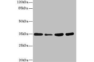 Western blot All lanes: UFD1 antibody at 3. (UFD1L 抗体  (AA 1-307))