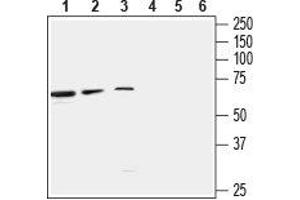 Western Blotting (WB) image for anti-gamma-aminobutyric Acid (GABA) A Receptor, beta 3 (GABRB3) (AA 413-425) antibody (ABIN7043191)