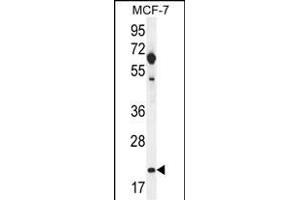 hCG_1646420 Antibody (Center) (ABIN656075 and ABIN2845422) western blot analysis in MCF-7 cell line lysates (35 μg/lane). (CLDN25 抗体  (AA 99-128))