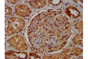 IHC image of ABIN7166989 diluted at 1:400 and staining in paraffin-embedded human kidney tissue performed on a Leica BondTM system.