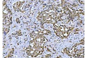 IHC analysis of TIF1 gamma using anti-TIF1 gamma antibody (ABIN3043492). (TRIM33 抗体  (AA 1001-1127))