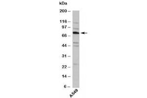 Western blot testing of human samples with TNFAIP2 antibody at 4ug/ml. (TNFAIP2 抗体  (Internal Region))