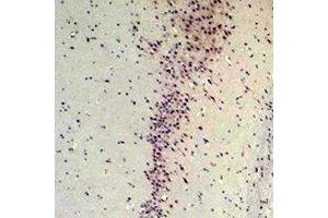 Immunohistochemical analysis of CABP2 staining in rat brain formalin fixed paraffin embedded tissue section. (CABP2 抗体)