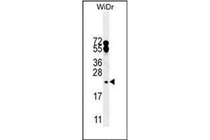 Western blot analysis of FAM96A Antibody (C-term) in WiDr cell line lysates (35ug/lane). (FAM96A 抗体  (C-Term))