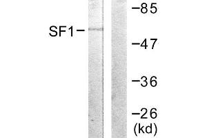 Western Blotting (WB) image for anti-Splicing Factor 1 (SF1) (Ser82) antibody (ABIN1847974)