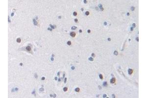 Detection of TFR in Human Cerebrum Tissue using Polyclonal Antibody to Transferrin Receptor (TFR) (Transferrin Receptor 抗体  (AA 567-744))