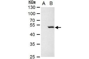 WB Image Chk1 antibody [C1C2-6], Internal detects Chk1 protein by western blot analysis. (CHEK1 抗体)