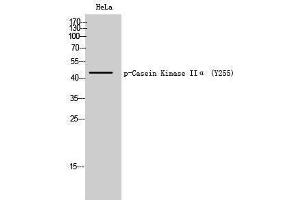 Western Blotting (WB) image for anti-Casein Kinase 2 alpha 1 (CSNK2A1) (pTyr255) antibody (ABIN3182287) (CSNK2A1/CK II alpha 抗体  (pTyr255))