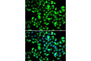 Immunofluorescence analysis of U2OS cells using GBP1 antibody (ABIN5974159). (GBP1 抗体)