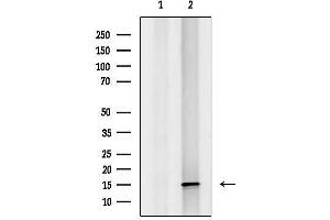 anti-Mitochondrial Ribosomal Protein S16 (MRPS16) antibody