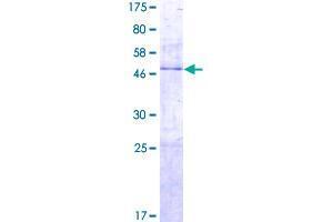 Image no. 1 for Peptidyl-tRNA Hydrolase 1 Homolog (PTRH1) (AA 1-214) protein (GST tag) (ABIN1316892) (PTRH1 Protein (AA 1-214) (GST tag))