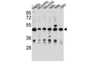 Western blot analysis of DUS1L Antibody (C-term) in HepG2, NCI-H460, NCI-H292, WiDr, Hela, U251 cell line lysates (35ug/lane). (DUS1L 抗体  (C-Term))