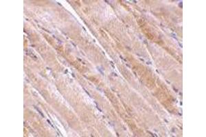 Immunohistochemistry of emerin in human skeletal muscle tissue with emerin antibody at 2. (Emerin 抗体  (N-Term))