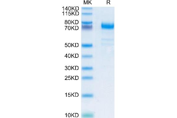 CD36 Protein (CD36) (AA 30-439) (His-Avi Tag)