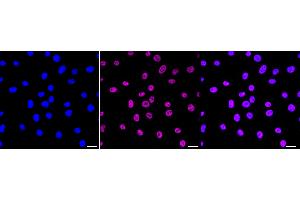 anti-Histone H2A (H2AK95ac) antibody