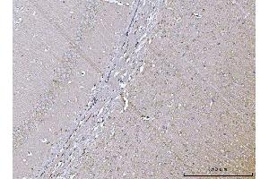 IHC analysis of VPS53 using anti-VPS53 antibody (ABIN7599731).