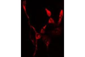 ABIN6276547 staining  Hela cells by IF/ICC. (FTH1 抗体  (C-Term))