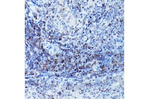 Immunohistochemistry (IHC) image for anti-SATB Homeobox 1 (SATB1) (AA 484-763) antibody (ABIN6147396)